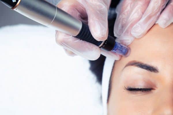 What Skin Concerns Can Total Skin Tightening Treatment Help With Seacombe?